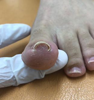 横山 みさき様 33歳女性Before