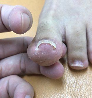 横山 みさき様 33歳女性After