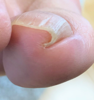 小栗 郁美様Before