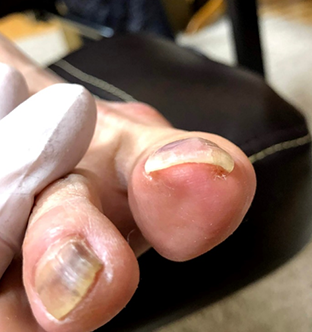 小栗 郁美様After