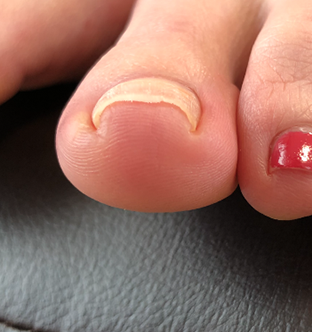 丹羽 亜矢様Before