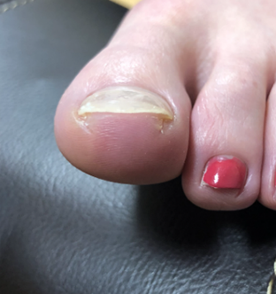 丹羽 亜矢様After