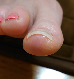 丹羽 亜矢様After