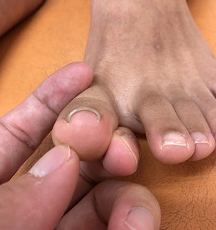 中川 愛梨様Before