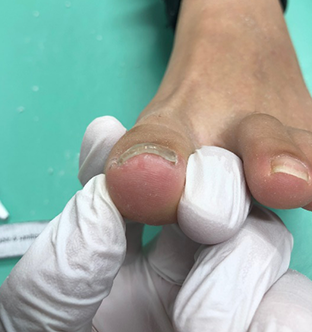 中川 愛梨様After