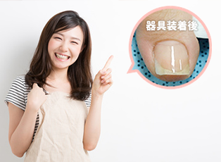 補正中も目立たないキレイな仕上がり